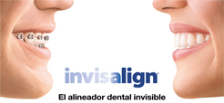 Clinica Dental Dr. Plocher ortodoncista - ortodoncia invisible - invisalign  